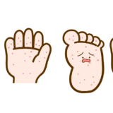 【医療・病気・症状】手足口病 湿疹が出ている手と足のフリーイラスト